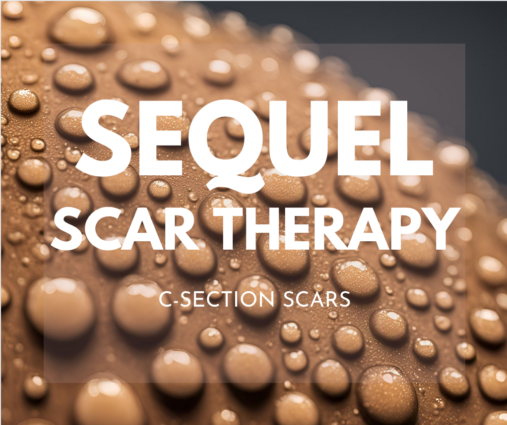 Obstetrician-Approved Products for C-section Scars - Sequel Scar Defense