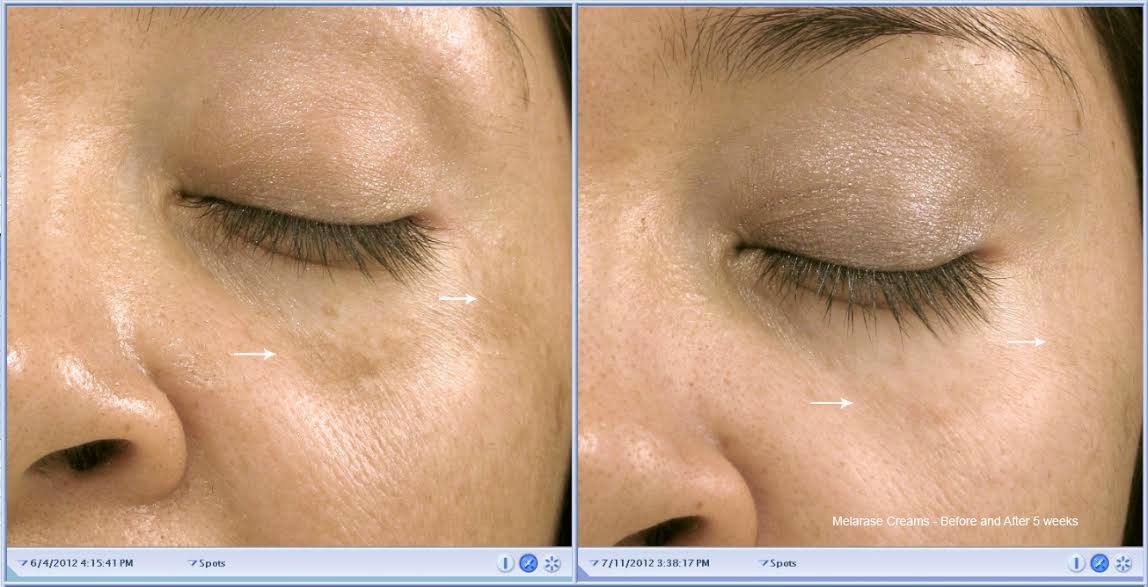 Melarase PM- Nighttime Brightener