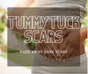 Tips to Fade and Lighten Tummy Tuck Scars (Abdominoplasty)