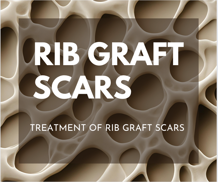 Treating Rib Cartilage Graft Scars on the Abdomen