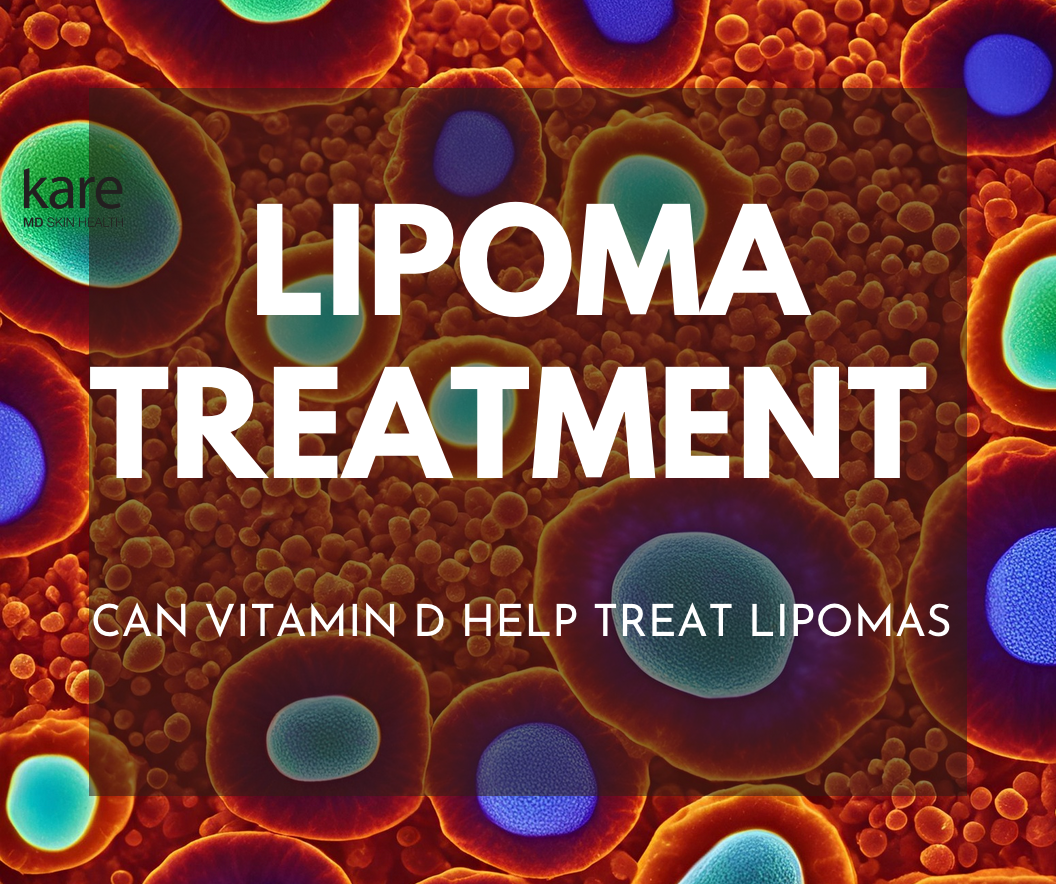 Can Vitamin D reduce a lipoma on the face or body?