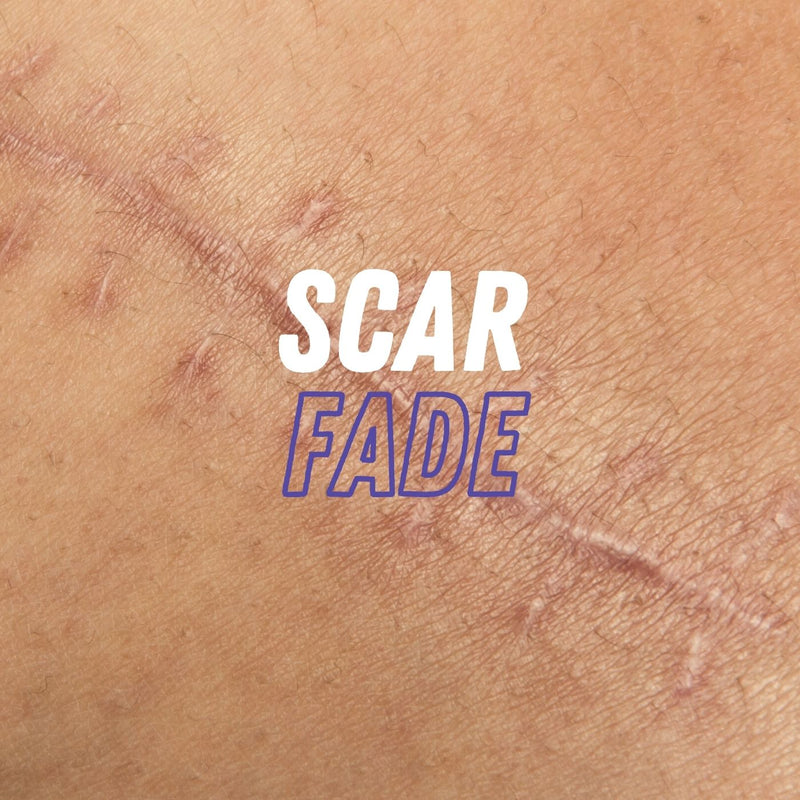 Kare MD Skin Health | Medical Skincare | Doctor Approved | Melasma